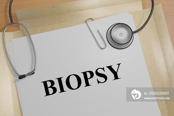 BIOPSY - medical procedure - concept