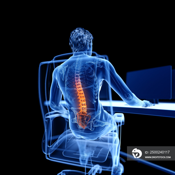 3d rendered medically accurate illustration of an office worker having a painful back