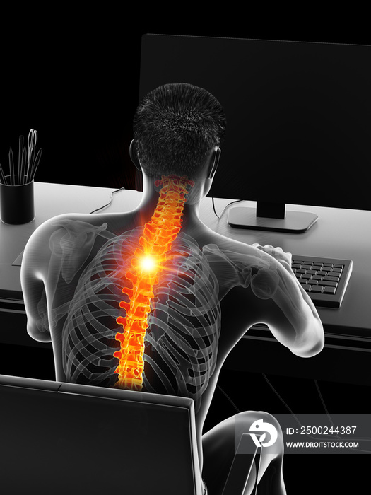 一名男子因坐着而背痛的3d医学精确图示