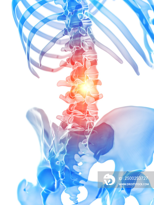 3d rendered medically accurate illustration of the lumbar spine showing pain