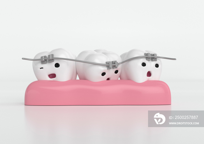 Modelo dental 3D de dientes tristes con ortodoncia, brackets dental, salud e higiene dental.