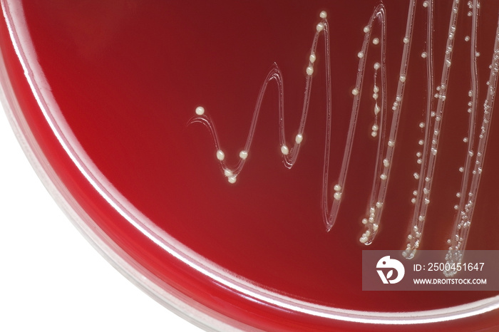 Streptococcus bacterial colonies with alpha hemolytic on blood a