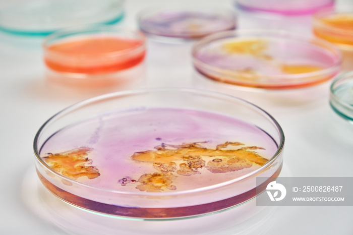 Petri dishes with colorful media for bacteria.