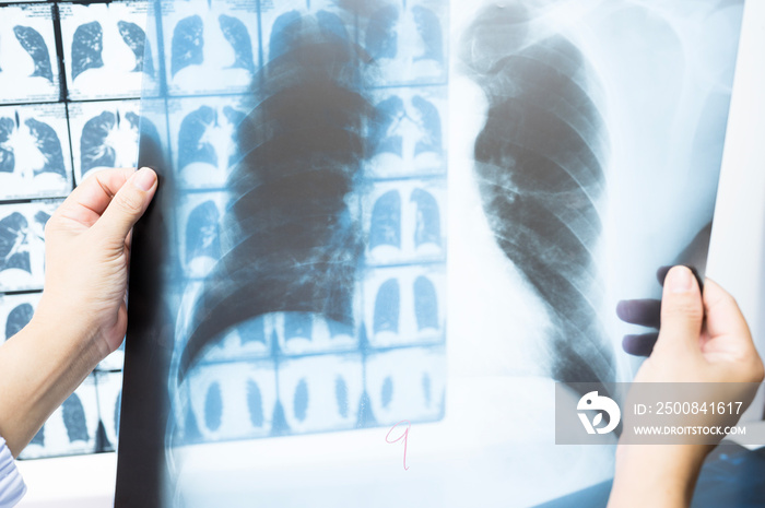 Woman doctor compare patient chest x-ray and CT scan film .Image lung at radiology department in hospital.Covid-19 scan body xray test detection for covid virus epidemic spread concept.