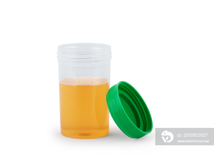 Medical urine test on white background