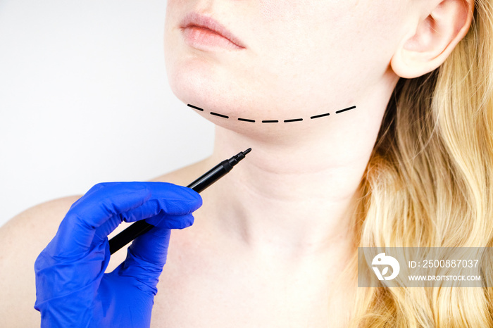 Mentoplasty: plastic chin. Patient before chin and neck surgery. Plastic surgeon advises