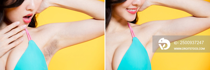 armpit hair removal concept