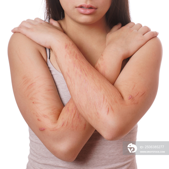 arms with scars and cuts from deliberate self-harm