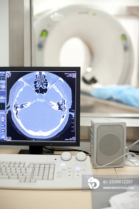医院CT扫描