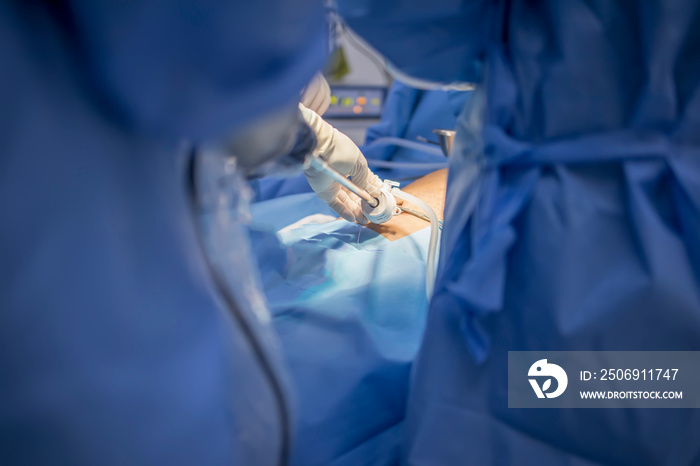 外科医生团队在剖腹胆囊结石切除手术中的双手特写