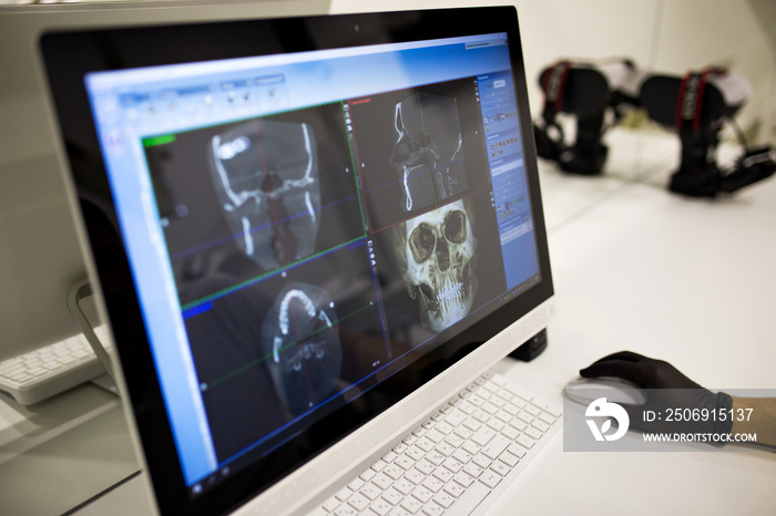 The male hand of the dentist on the monitor screen shows the jaw.