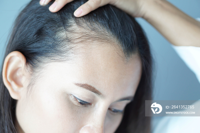 Woman looking reflection in the mirror serious hair loss problem for health care shampoo and beauty 