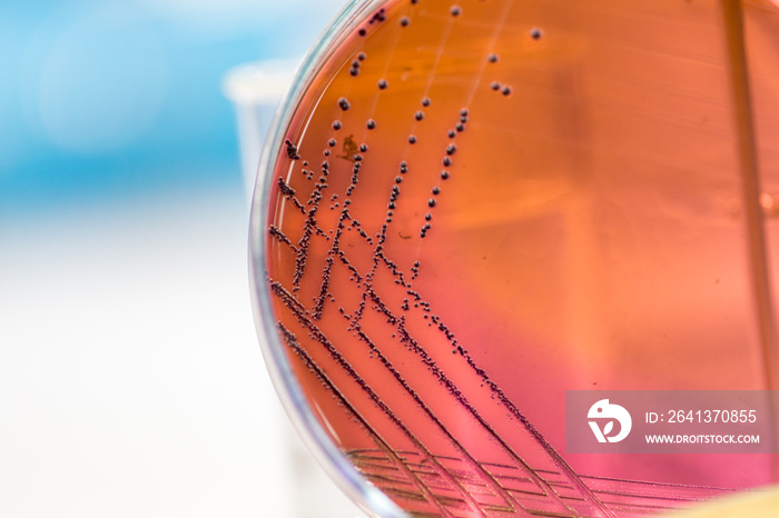 Colony Characteristics of Escherichia coli (E. coli) is a Gram-negative, facultatively anaerobic, ro