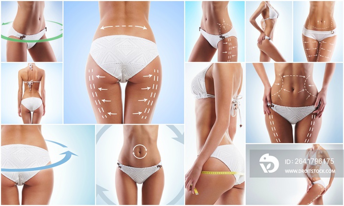 Collage of a female body with arrows. Fat lose, health, sport, fitness, nutrition, liposuction, heal