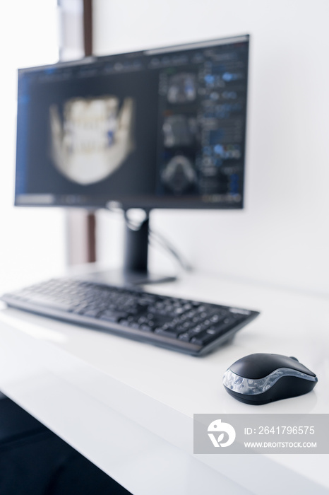 Human teeth x-ray analysis on computer monitor. Modern dental clinic.