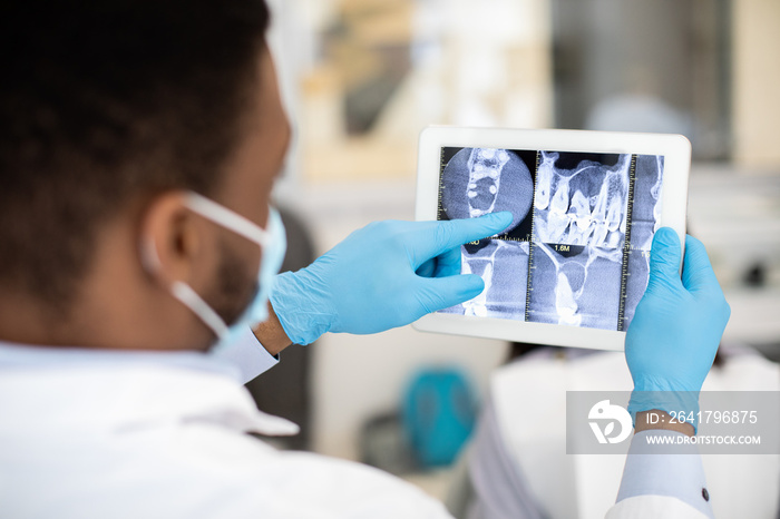 男性黑人牙科医生在数字平板电脑上检查牙齿X射线照片