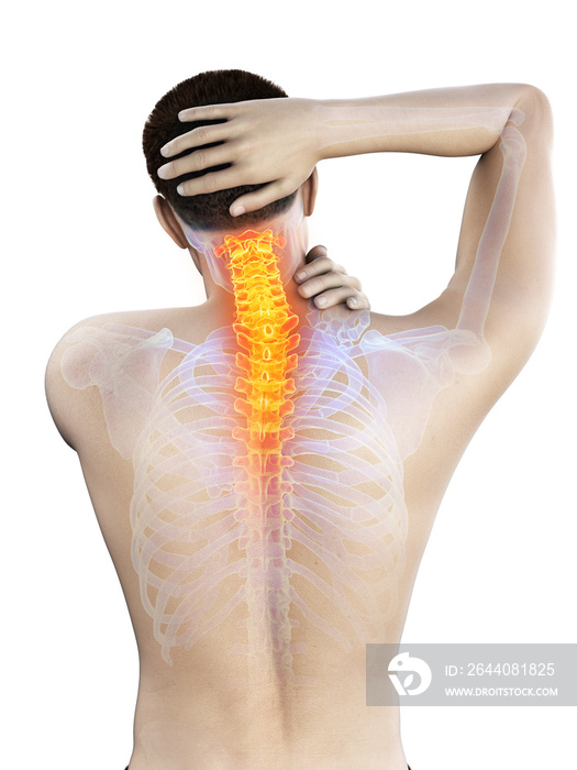 一名男子颈部疼痛的3d医学精确图示