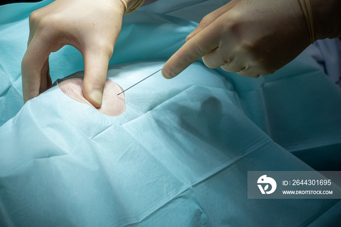 doctor performs a knee puncture in an operating room with a cannula and a syringe