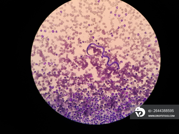 Microfilariae are not sheathed in the blood smear of a dog. Light microscope of heartworms, Dirofilaria immitis.