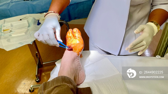 the nurse clean the patient feet before an operation. Background Blurred