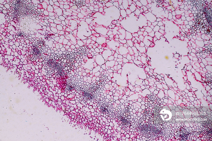 Host cells with spores (mold) are inside wood under the microscope for education.