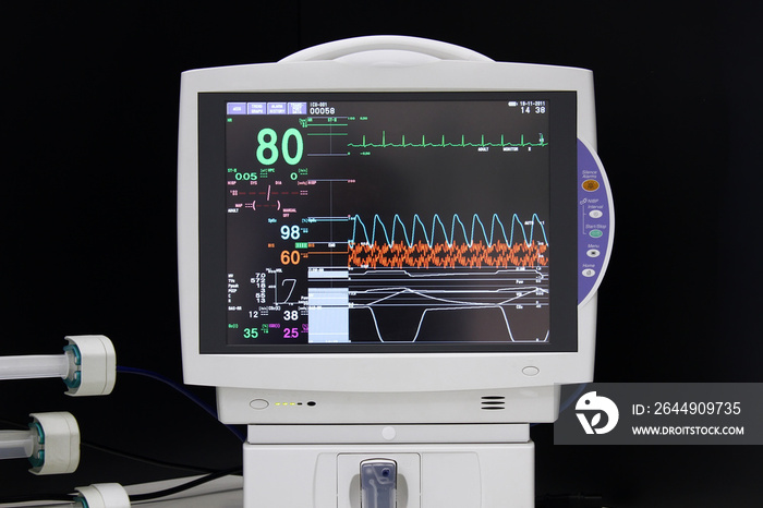 EKG monitor