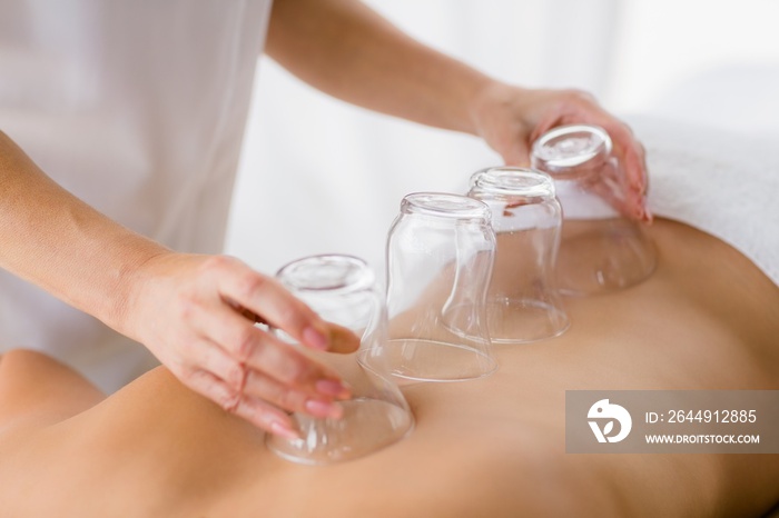 Masseur giving suction massage to woman