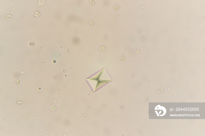 Calcium oxalate at the microscope. Urine sample from a cat with urinary infection