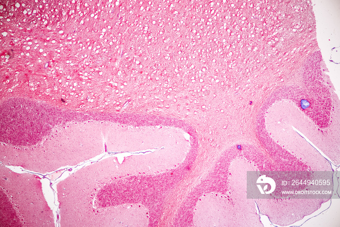 Education Spinal cord, Nerve, Cerebellum, Cortex and Motor Neuron Human under the microscope in Lab.