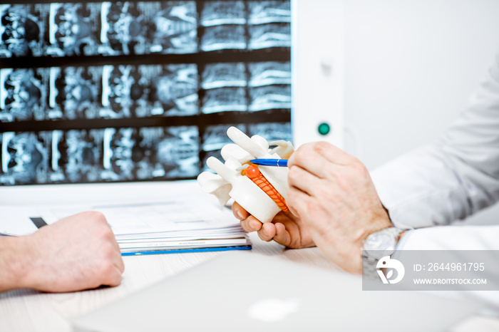 Close-up of therapist holding anatomical model of vertebras with intervertebral hernia