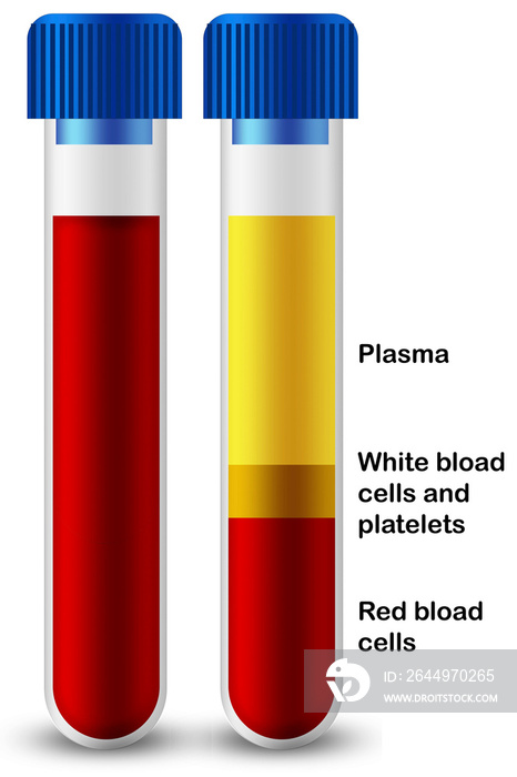 Blood composition of platelets, red blood and white blood cells in medical test tube