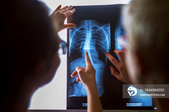 Rear view of blurred women checking X-ray in a doctors office.