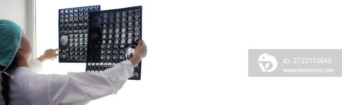 Doctor holding a picture of a brain MRI