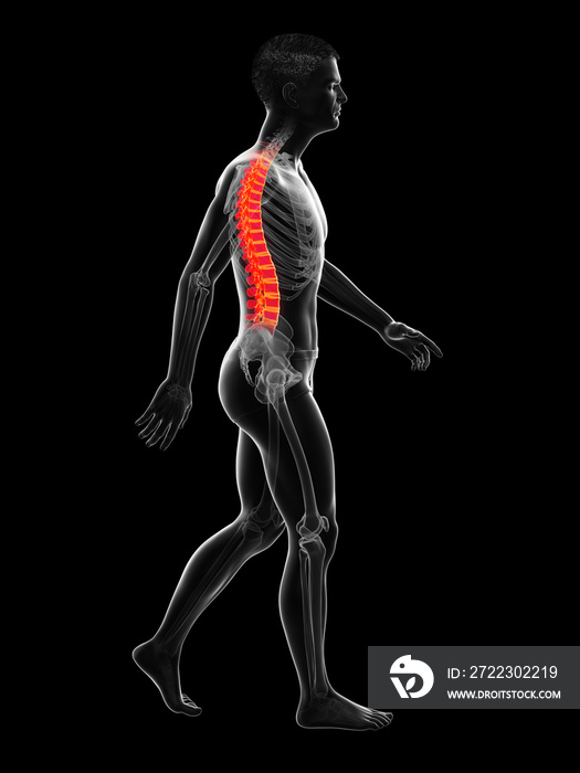 背部疼痛的三维医学精确图示