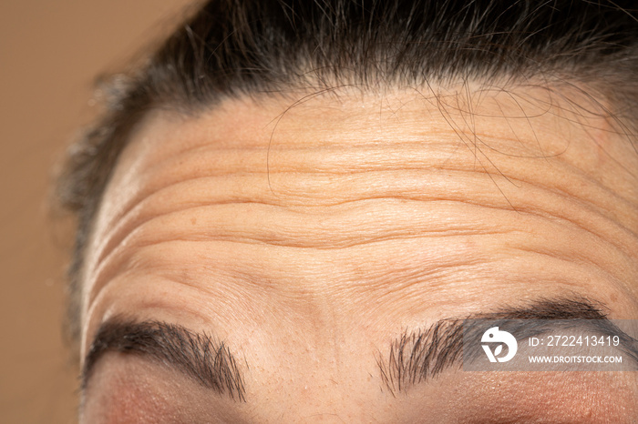 Close up of forehead with wrinkles of young woman