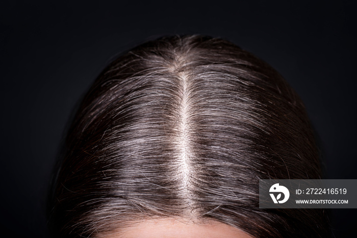 Womens head with gray hair, close-up view of regrown roots, top view on dark background.