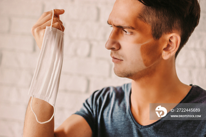 Portrait of angry young man with funny sunburn lines holding medical face mask in hand. Confused hipster man with sun tanned lines on face after wearing protective face mask. COVID-19 prevention