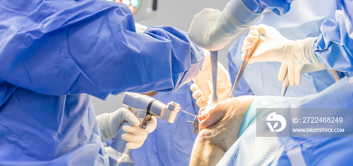 Selective focus with blurred background.Orthopedic surgeon in blue surgical gown suite using saw to cut the bone while total knee replacement surgery in osteoarthritis patient.Team of surgeons.