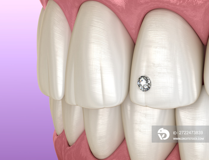 Tooth piercing by diamond, 3D illustration concept.