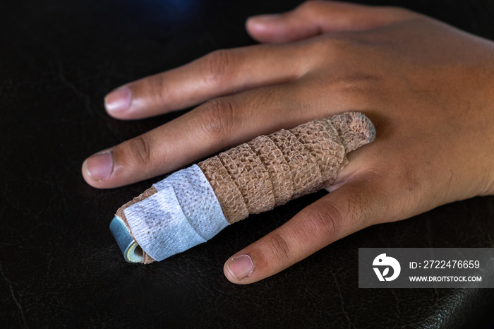 Aluminium Finger Splint on a Woman Ring Finger, Treatment Of Finger Injuries.