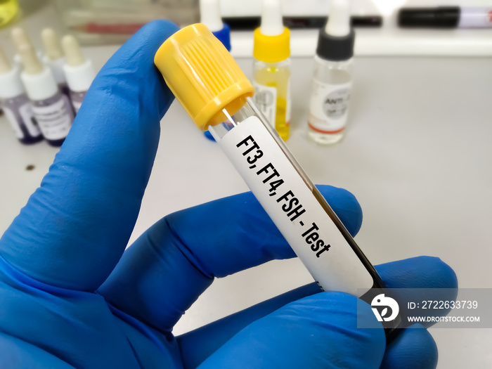 Blood sample in test tube for hormonal examination of thyroid gland in laboratory. FT3, FT4, FSH. Diagnosis of hyperthyroidism or hypothyroidism of a patient