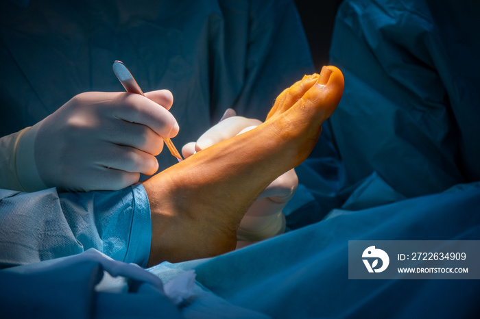 surgeon makes an incision on one foot with a scalpel