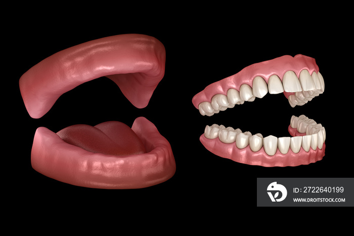 Maxillary and Mandibular prosthesis, artificial dentures. Medically accurate 3D illustration of human teeth and dentures