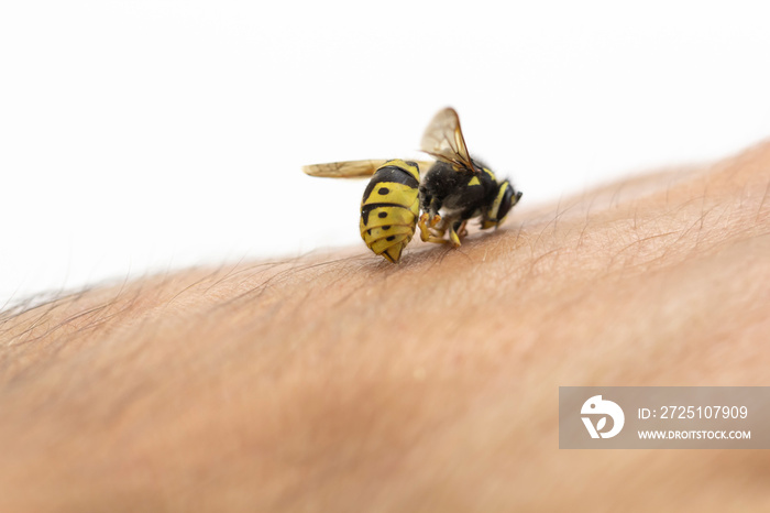 Bee stinging in human hand