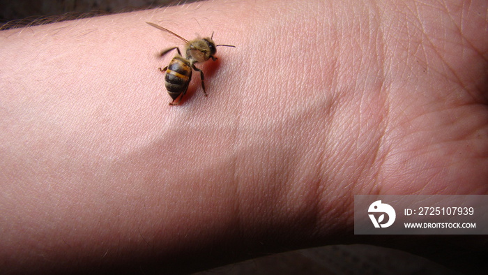 bee : apis mellifera treatment by honey bee sting closeup honey bee stinging a hand close up bee wor