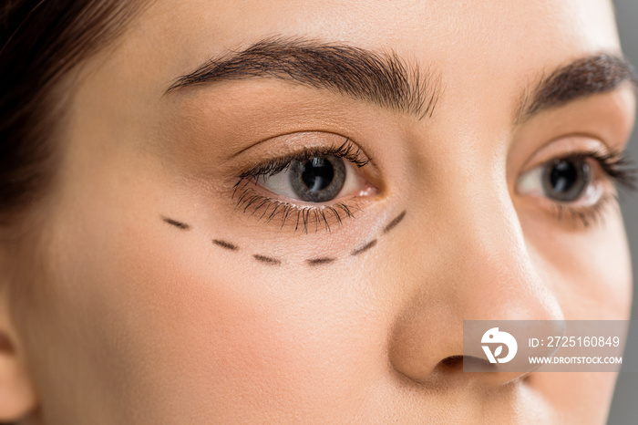 cropped view of young woman with marks on face isolated on grey