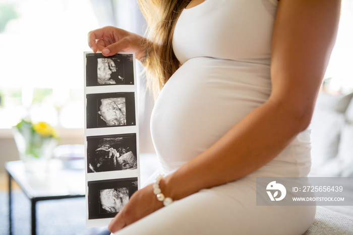 Close-up of pregnant woman holds ultrasound photos at her stomach