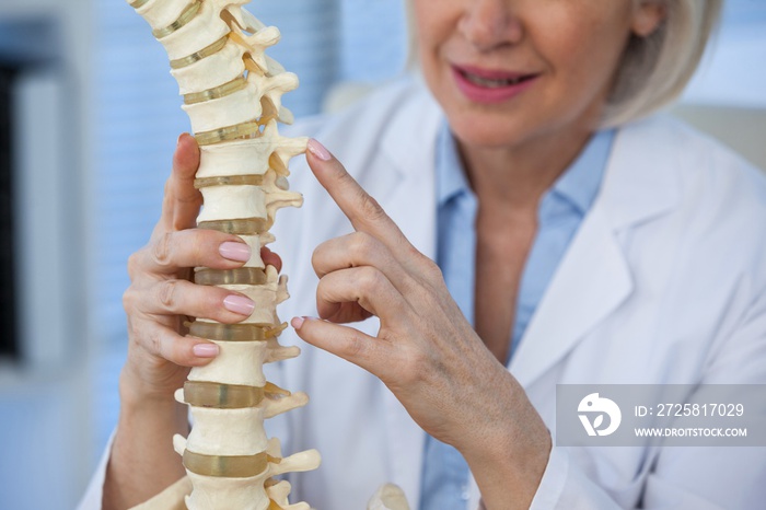 Female doctor holding spine model