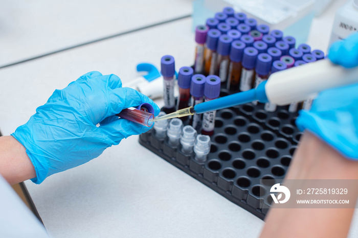 Blood test in the laboratory. Laboratory assistant working with the dispenser. Vacuum tubes with blo