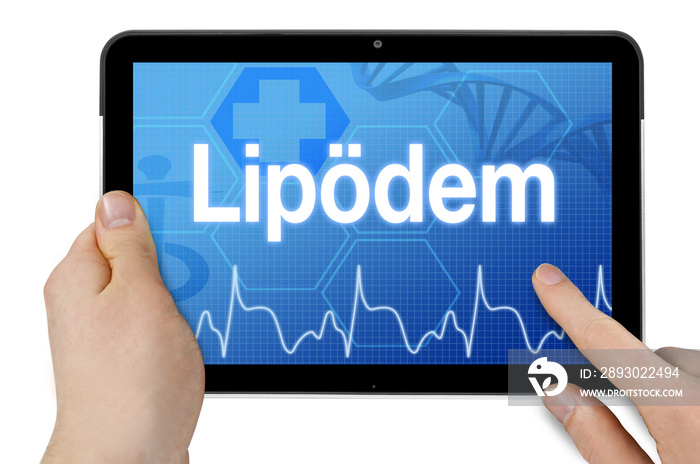 Tablet mit Diagnose Lipödem Fettschwellung